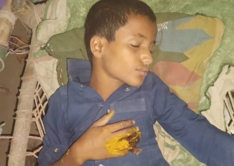 مدرس يعذب طفل في حجة مديرية بني قيس و التربية تتستر 