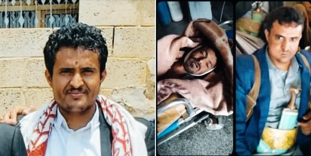 مقتل وإصابة "13" مواطنا مدنيا جراء صواعق رعدية ضربت محافظتين يمنيتين