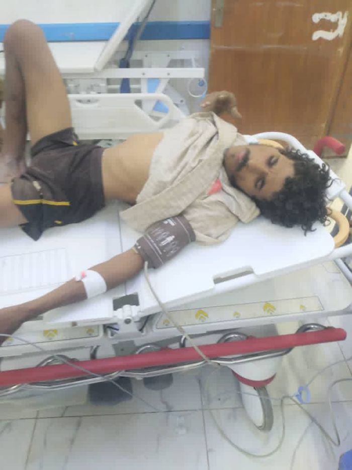 انفجار لغم حوثي في محافظة الجوف يسفر عن إصابة مواطن مدني بجروح بالغة