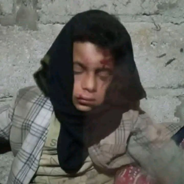 شاهد صورة لطفل دمت الذي إعتدى عليه عدد من الأشخاص واشعل مواقع التواصل والرأي العام 