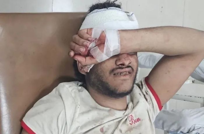 تعز.. قناص حوثي يصيب مواطن مدني بطلقة نارية