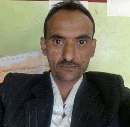 بعد أيام من اختطافه .. الإفراج عن صحفي من قبل الحوثيين (تفاصيل)