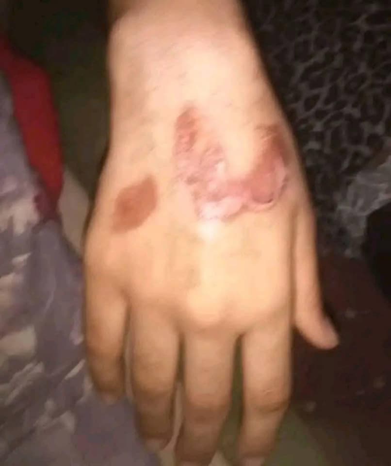 أحرق جسدها وحلق شعرها وحبسها لمدة شهر .. جريمة هزت تعز وبطلها محامي يمني 