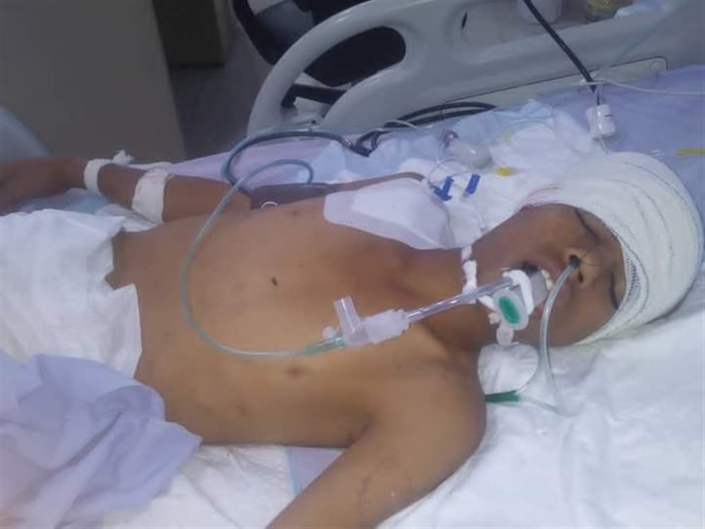 بقناصة مليشيا الحوثي .. استهداف طفل شمال هذه المدينة