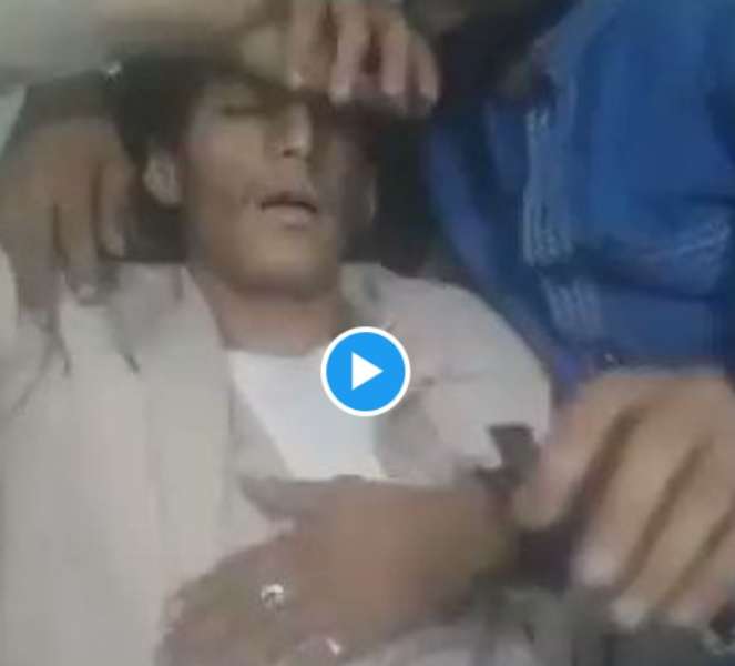 بعد أسبوع من التعذيب.. مليشيا الحوثي تُفرج عن شاب مختطف فاقدًا وعيه!