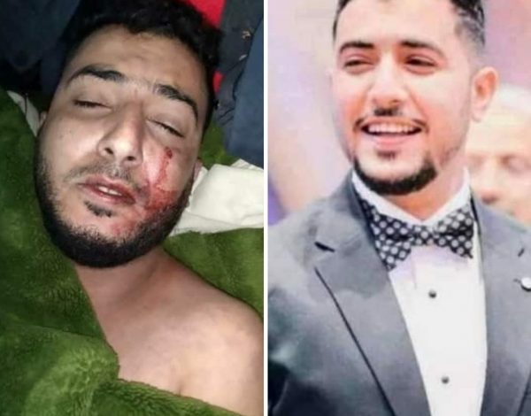 بكلمات يدمي لها القلب .. والدة الشهيد "السنباني"  تنشر صورة لها مع ابنها وهو طفلا وتثير تفاعلا واسع (صورة)