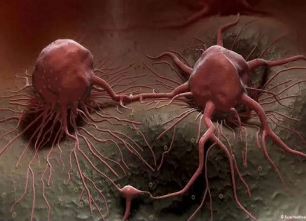 بشرى سارة لمرضى السرطان في العالم يعلن عنها ملك بريطانيا !