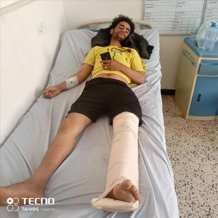 قناص حوثي يستهدف مواطن مدني في الضالع