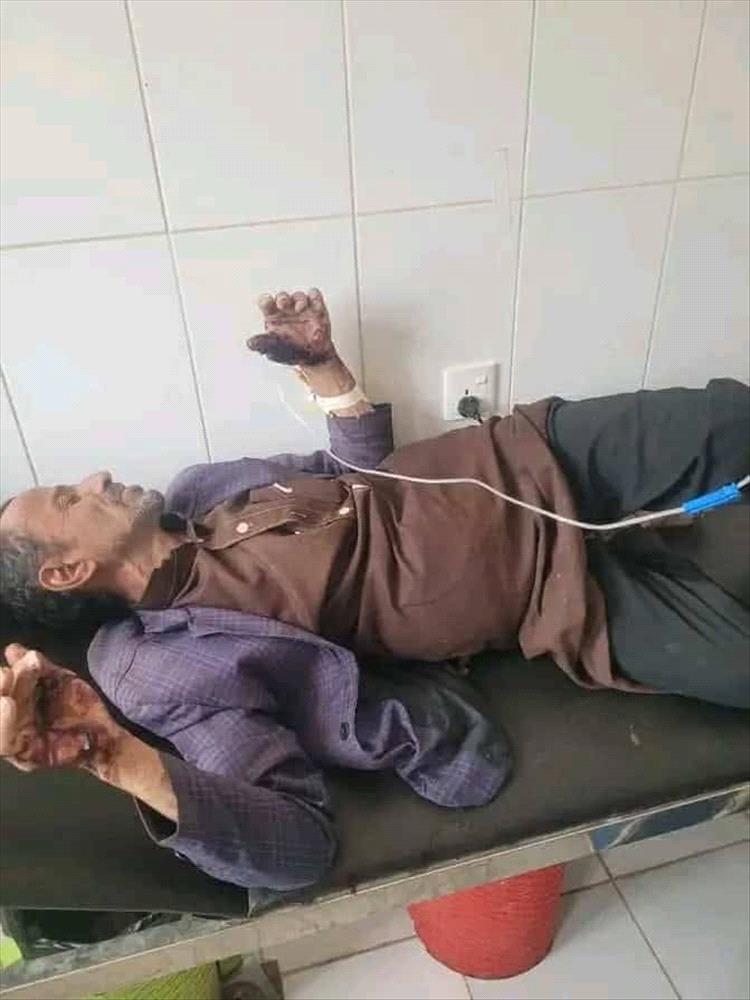  رجل يمني يهزم حيوان مفترس أنقض عليه والنجاة من الموت .. تفاصيل 