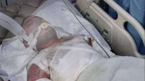 في مدينة تحت سيطرة الحوثيين .. إحراق مواطن أمام الناس