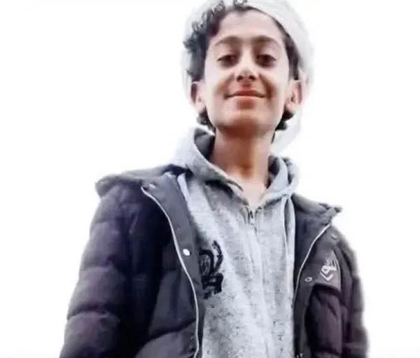 الظروف الاقتصادية تدفع أب في صنعاء لضرب أبنه بعصا غليظة حتى الموت !