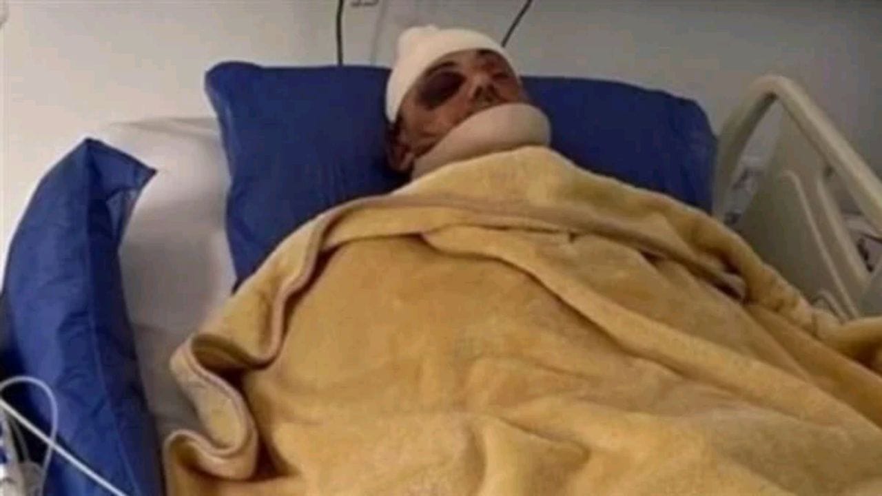 فنان مشهور يتعرض لقطع الأذن .. والسبب غير متوقع