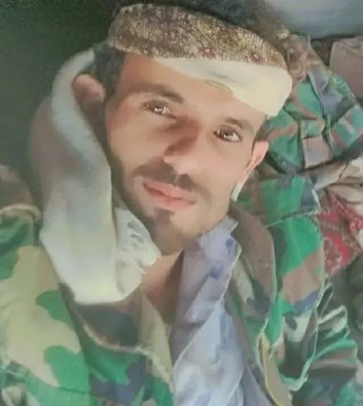 ذمار.. العثور على سائق شاحنة مقتول جنوب المحافظة