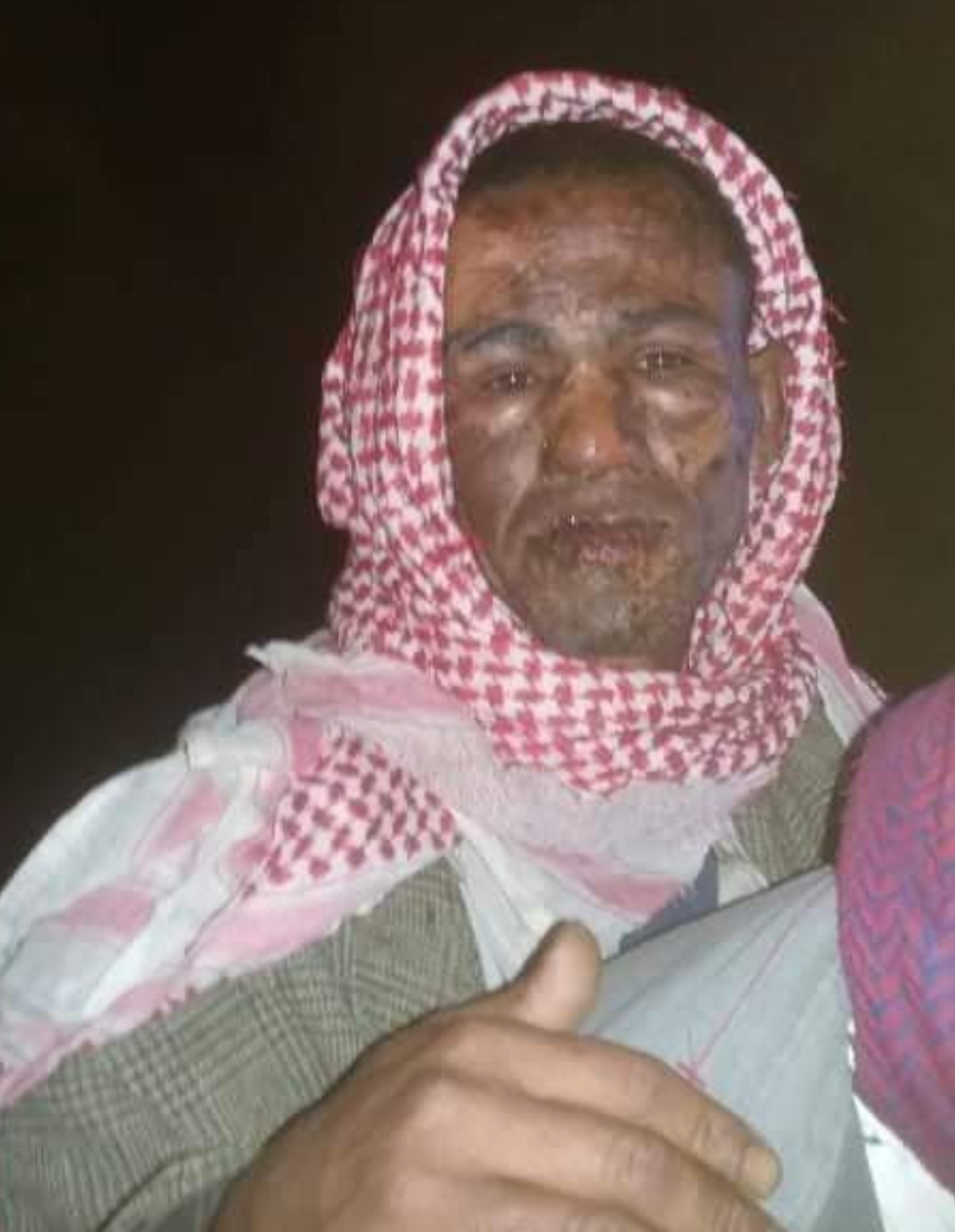 حادثة تهز الشعب ..شاهد مافعله شباب يمنيين بهذا المختل عقلياً 