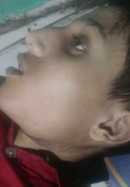  صورة لطفل عثر عليه مشنوقاً داخل أحد مطاعم في محافظة إب 
