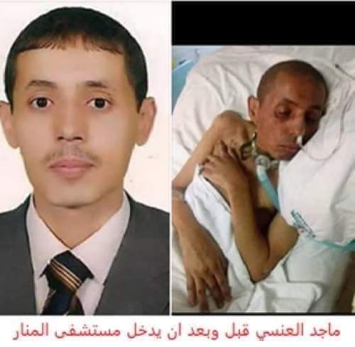 ماجد العنسي مواطن يمني ذهب للمستشفى على قدميه وحقنوه بإبرة سببت له الموت سريرياً .. صورة