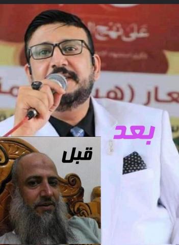 صورة لقيادي حوثي بارز تثير جدلا واسعا أجرى عملية تجميل وتحول إلى شخص آخر وهكذا أصبح .. الاسم