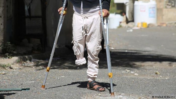 6 ضحايا مدنيين أغلبهم أطفال بحوادث الألغام في الحديدة