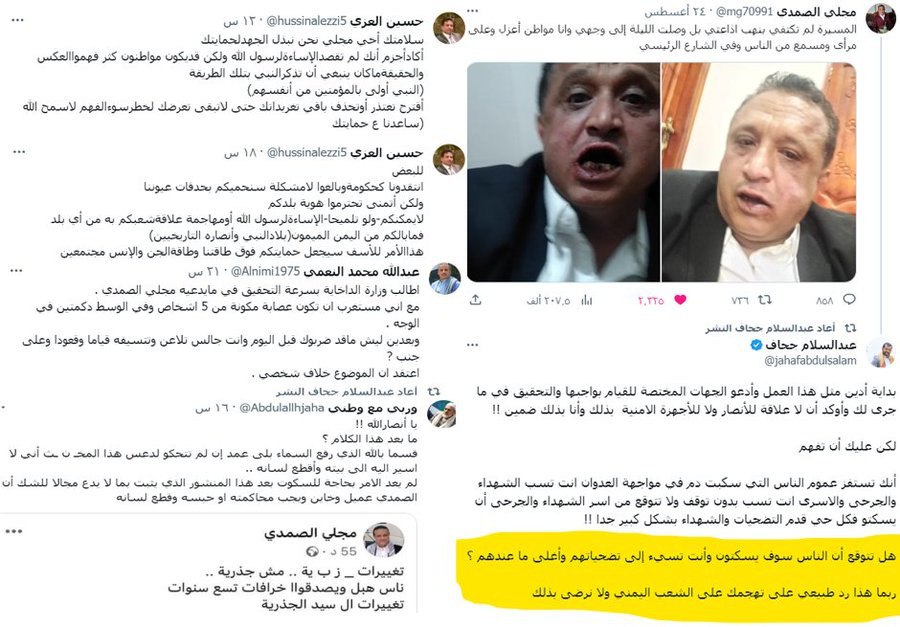 محاولة حوثية للتغطية على جريمة الاعتداء على الصحفي مجلي الصمدي..