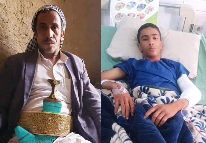 في ملابسات مخيفة.. مليشيا الحوثي تقتل شيخ قبلي وتصيب اثنين من أقاربه!