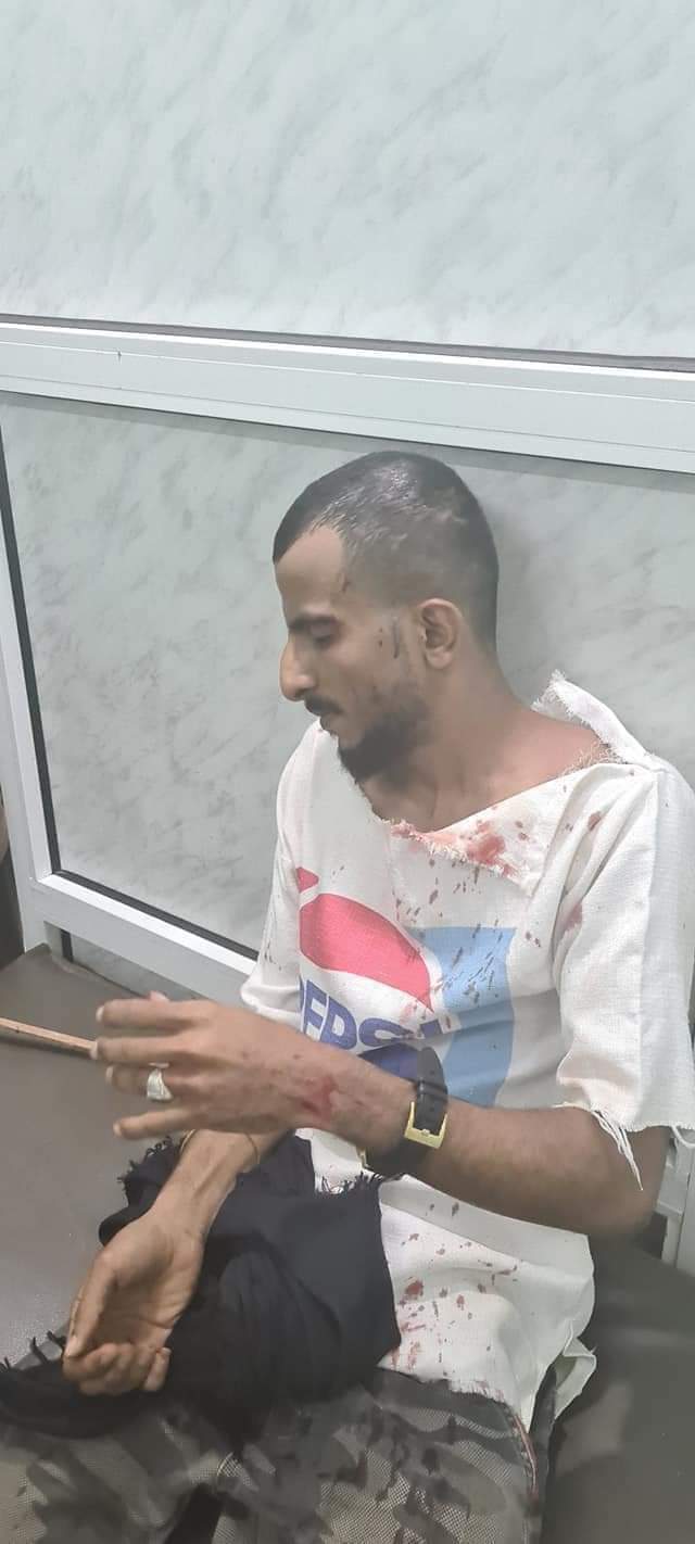 إعتدو على بائع الماء الكبير في السن فتدخل ابن عدن لمنعهم فاشبعوه ضرباً .. تفاصيل إنتهاك هز اليمن .. صورة