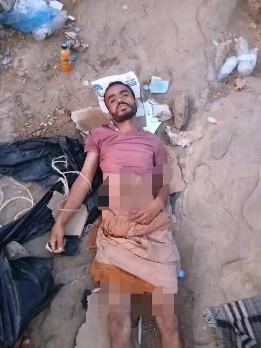 مواطن يمني شعر بالعطش على الحدود اليمنية السعودية و شرب ماء راكد وهكذا كانت نهايته !!